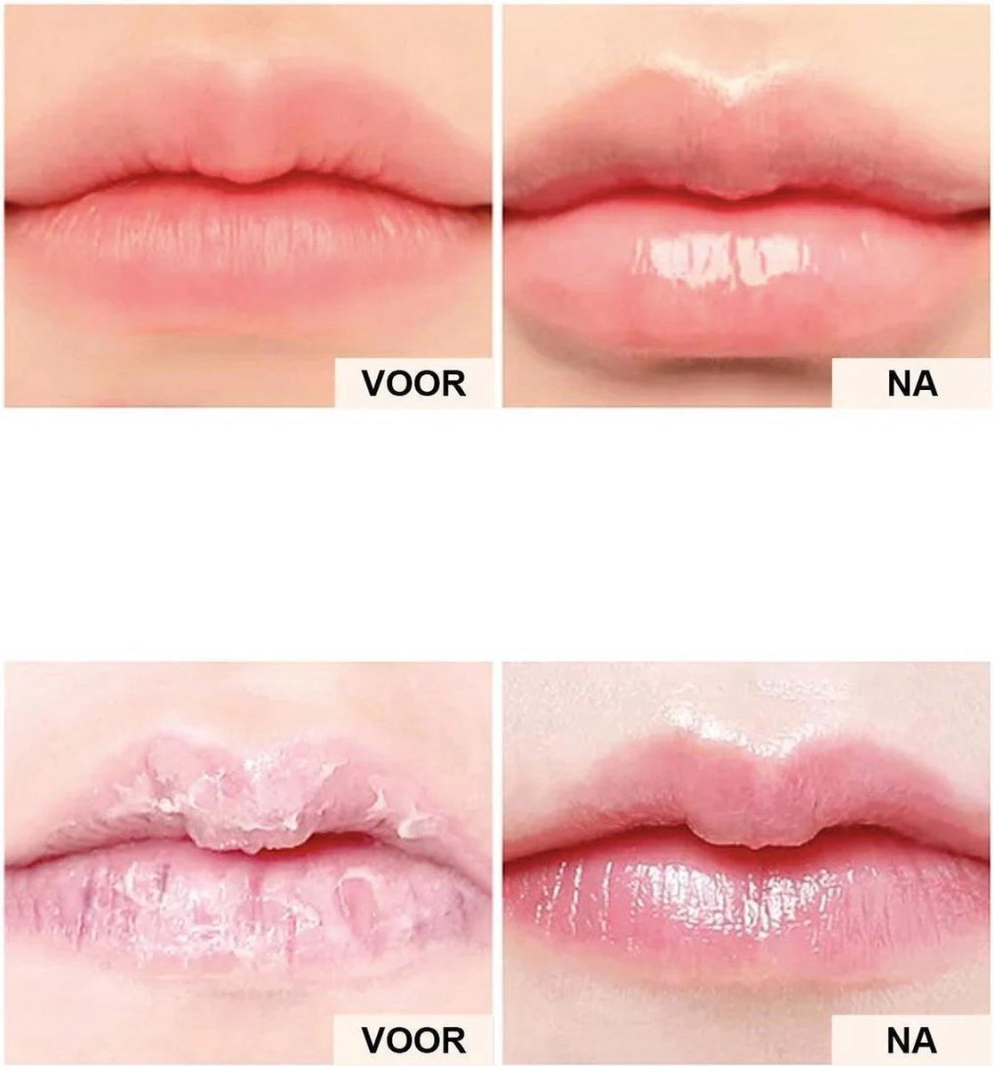 2 Stuks DAG En Nacht Lip Plumpers | Natuurlijke Lip Plumpers | 50% Vollere Lippen In 2 Min | Lip Filler | Lipgloss | Lip Maximizer | Cadeautip | In Een Schattige Cadeauverpakking! - Afbeelding 6