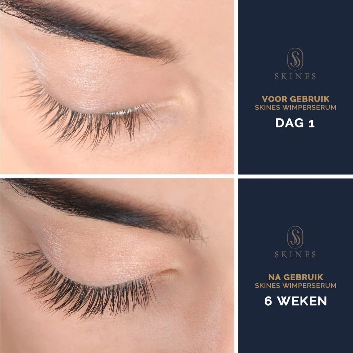 Skines® Wimperserum Premium – Eyelash Serum - Wenkbrauw Serum - Wimper Groei - 3ML - Afbeelding 2
