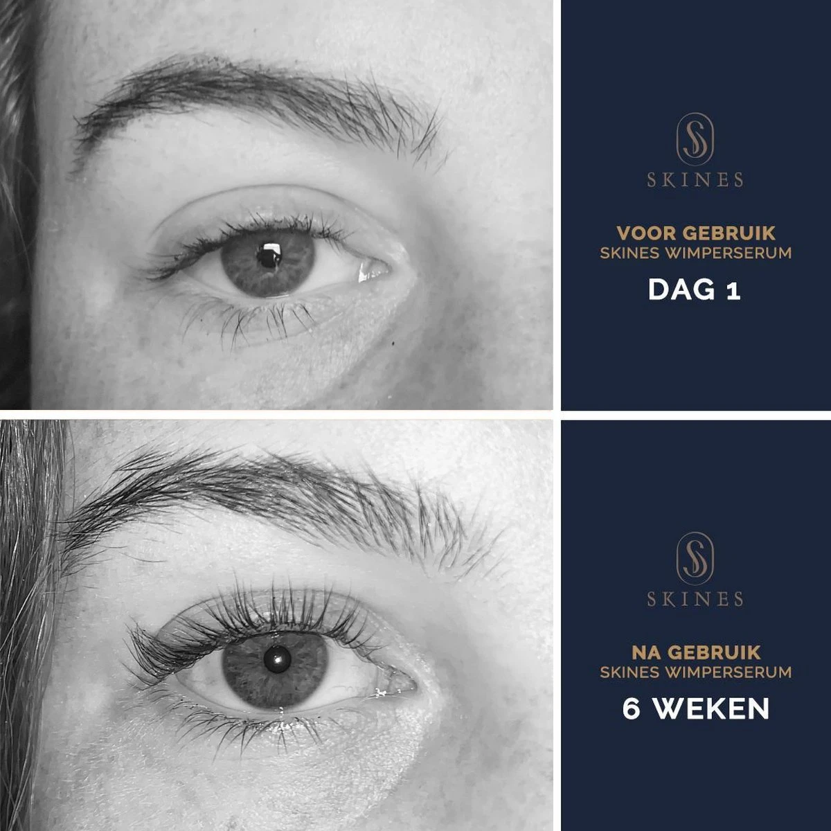 Skines® Wimperserum Premium – Eyelash Serum - Wenkbrauw Serum - Wimper Groei - 3ML - Afbeelding 6